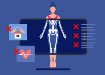 découvrez nos solutions d'assurance prêt immobilier adaptées aux personnes atteintes de sclérose en plaques en 2025. profitez d'une couverture sur mesure qui vous accompagne dans vos projets immobiliers tout en tenant compte de votre état de santé.